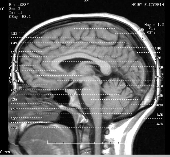 5 Essential Brain Hacks for Fiction